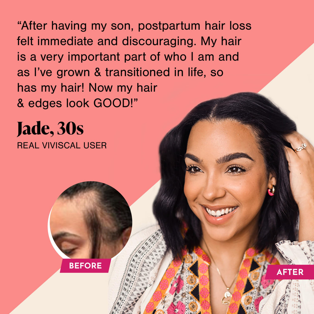 Viviscal Advanced Hair Growth Supplements for Women